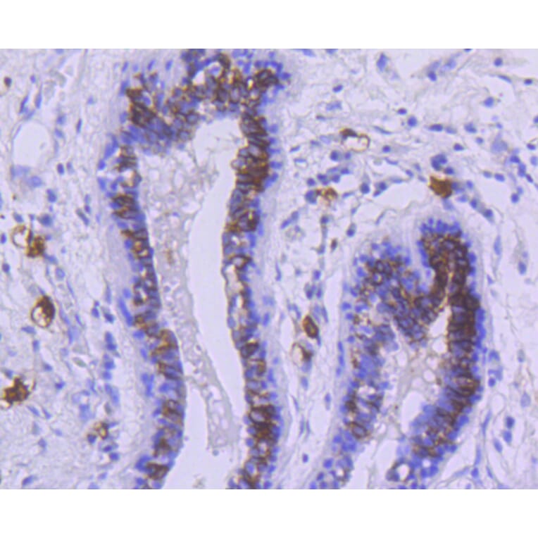 Immunohistochemistry - Anti-KIT Antibody (A10933) - Antibodies.com