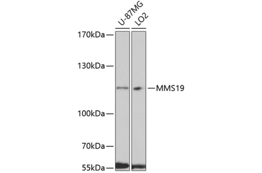 Western Blot - Anti-MMS19 Antibody (A10944) - Antibodies.com