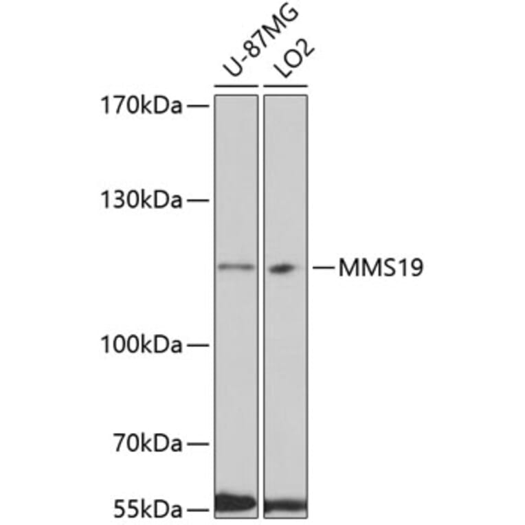 Western Blot - Anti-MMS19 Antibody (A10944) - Antibodies.com