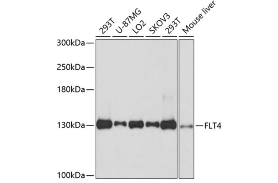 Western Blot - Anti-FLT4 Antibody (A10971) - Antibodies.com