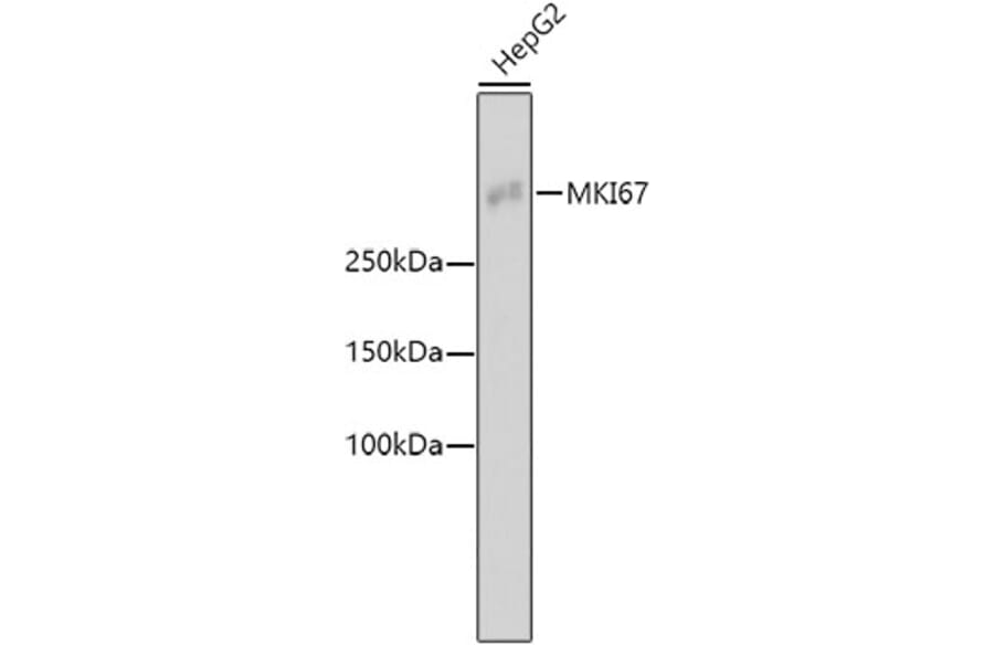 Western Blot - Anti-MKI67 Antibody (A11005) - Antibodies.com