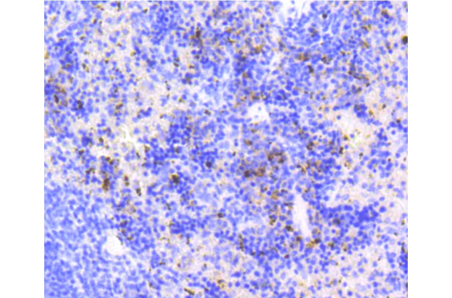 Immunohistochemistry - Anti-MKI67 Antibody (A11005) - Antibodies.com