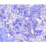 Immunohistochemistry - Anti-MKI67 Antibody (A11005) - Antibodies.com