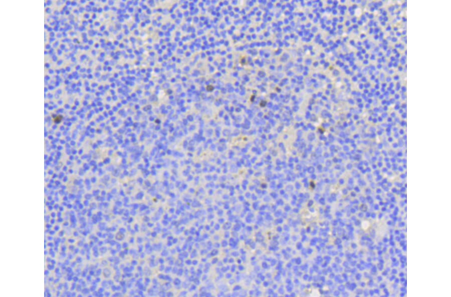 Immunohistochemistry - Anti-MKI67 Antibody (A11005) - Antibodies.com