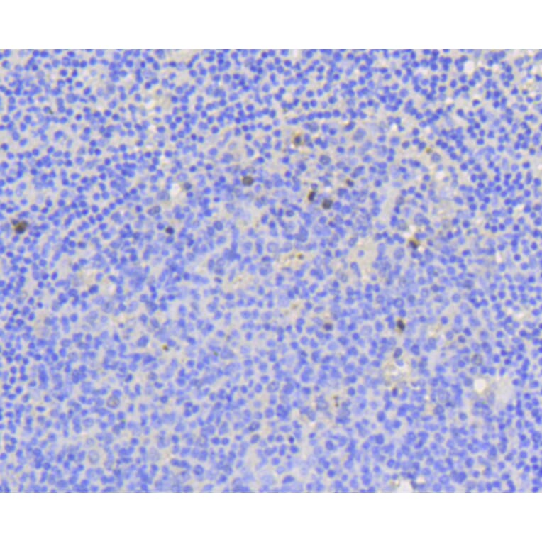 Immunohistochemistry - Anti-MKI67 Antibody (A11005) - Antibodies.com