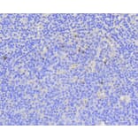 Immunohistochemistry - Anti-MKI67 Antibody (A11005) - Antibodies.com