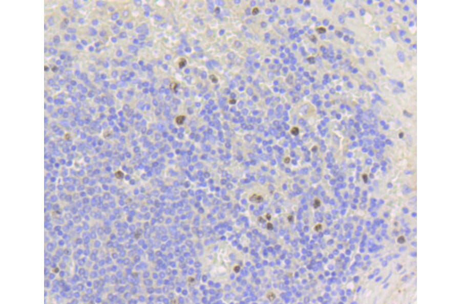 Immunohistochemistry - Anti-MKI67 Antibody (A11005) - Antibodies.com