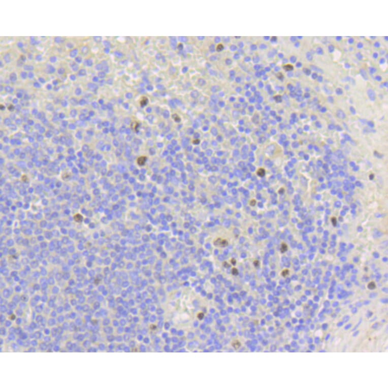 Immunohistochemistry - Anti-MKI67 Antibody (A11005) - Antibodies.com