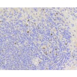 Immunohistochemistry - Anti-MKI67 Antibody (A11005) - Antibodies.com