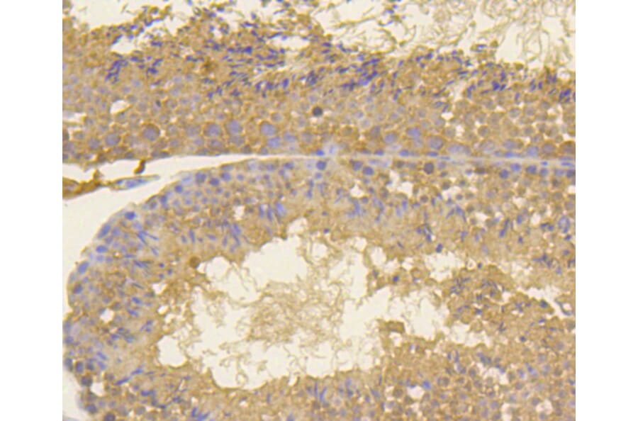 Immunohistochemistry - Anti-MKI67 Antibody (A11005) - Antibodies.com