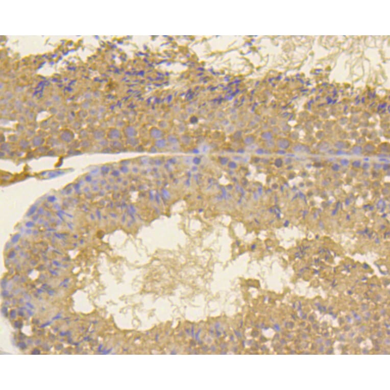 Immunohistochemistry - Anti-MKI67 Antibody (A11005) - Antibodies.com