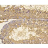 Immunohistochemistry - Anti-MKI67 Antibody (A11005) - Antibodies.com