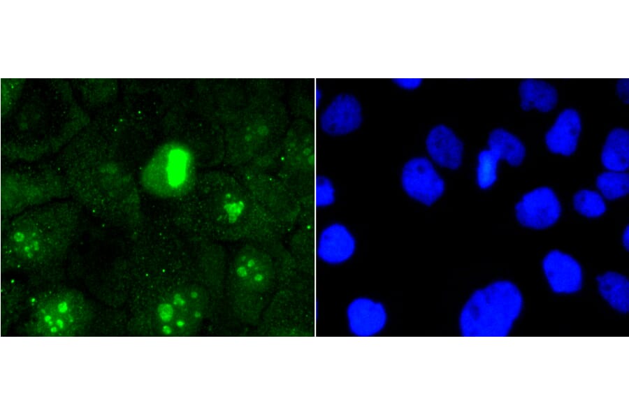 Immunofluorescence - Anti-MKI67 Antibody (A11005) - Antibodies.com