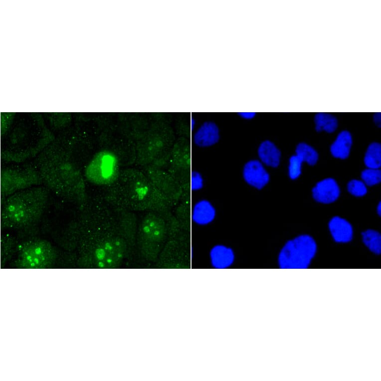 Immunofluorescence - Anti-MKI67 Antibody (A11005) - Antibodies.com