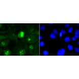 Immunofluorescence - Anti-MKI67 Antibody (A11005) - Antibodies.com