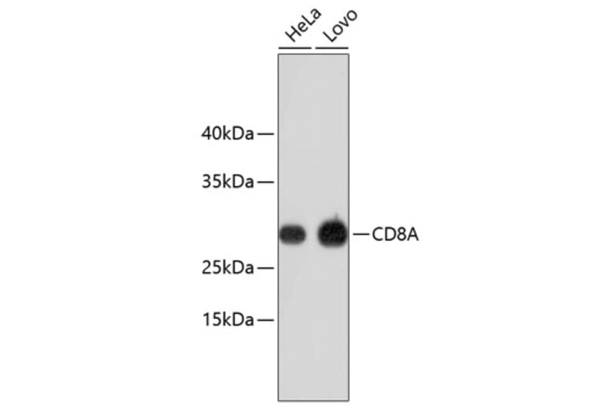 Western Blot - Anti-CD8A Antibody (A11033) - Antibodies.com