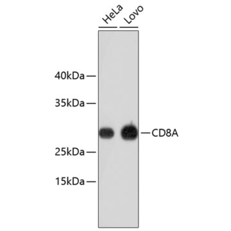 Western Blot - Anti-CD8A Antibody (A11033) - Antibodies.com
