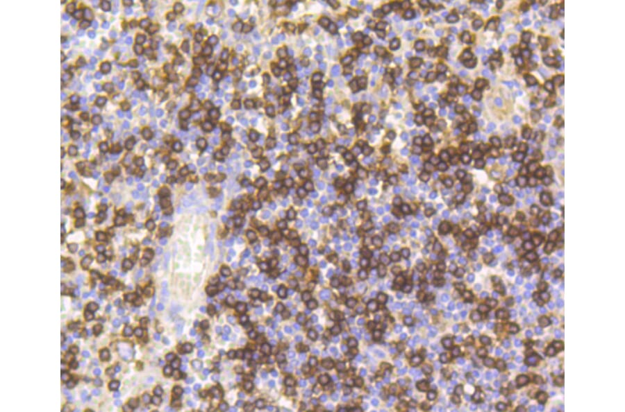 Immunohistochemistry - Anti-CD8A Antibody (A11033) - Antibodies.com
