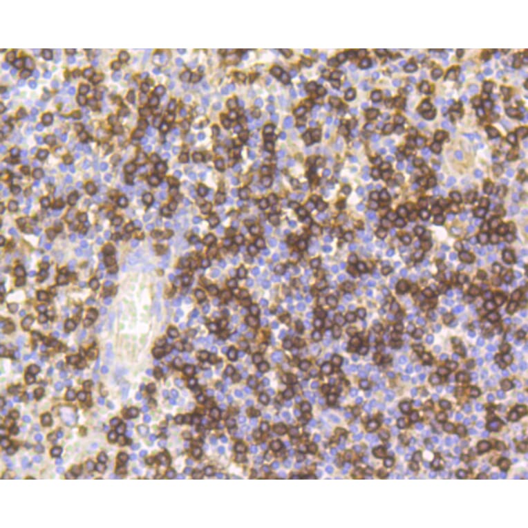 Immunohistochemistry - Anti-CD8A Antibody (A11033) - Antibodies.com