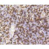 Immunohistochemistry - Anti-CD8A Antibody (A11033) - Antibodies.com