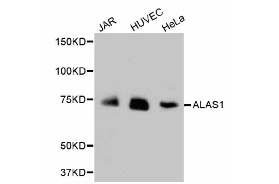 Western Blot - Anti-ALAS1 Antibody (A11120) - Antibodies.com