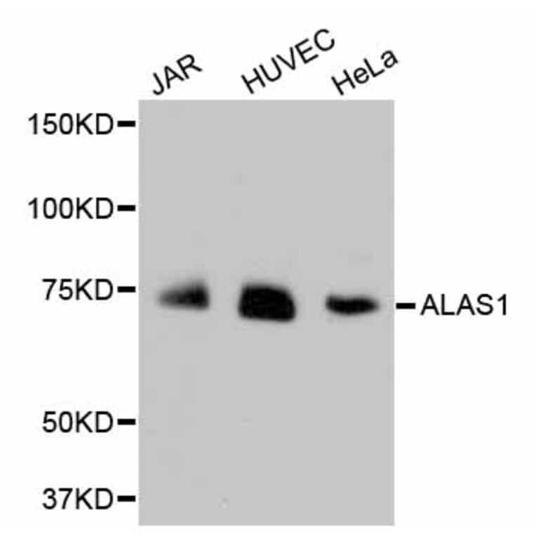Western Blot - Anti-ALAS1 Antibody (A11120) - Antibodies.com
