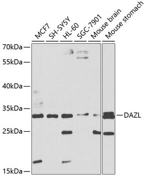Western blot analysis of extracts of various cell lines, using Anti-DAZL Antibody (A1114) at 1:1,000 dilution.
Secondary antibody: Goat Anti-Rabbit IgG (H+L) (HRP) (AS014) at 1:10,000 dilution.
Lysates / proteins: 25µg per lane.
Blocking buffer: 3% non-fat dry milk in TBST.
Detection: ECL Basic Kit (RM00020).
Exposure time: 30s.