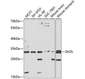 Western Blot - Anti-DAZL Antibody (A8858) - Antibodies.com
