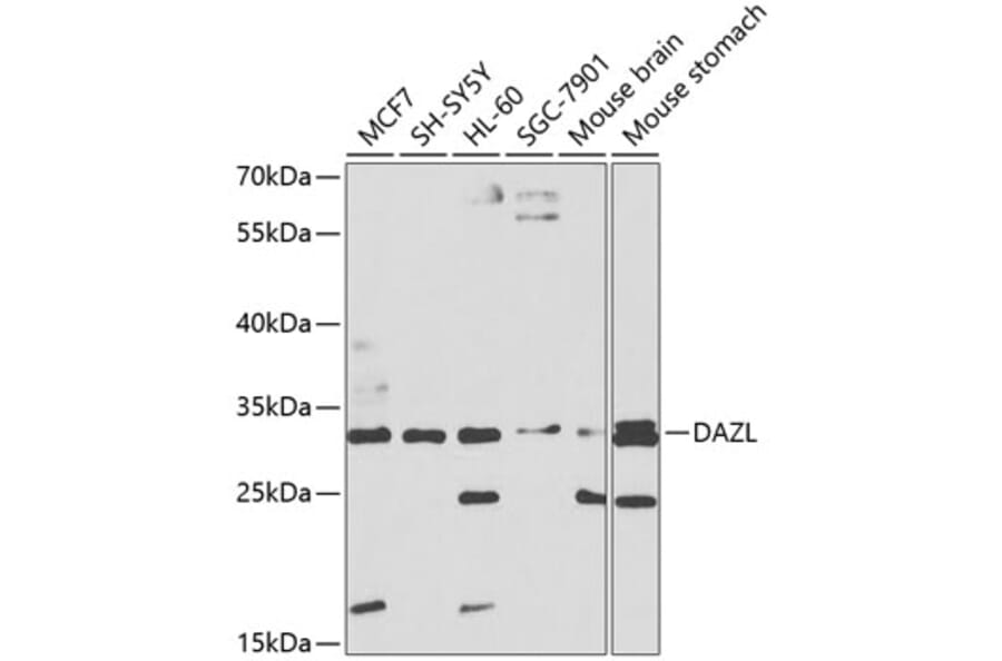 Western Blot - Anti-DAZL Antibody (A8858) - Antibodies.com