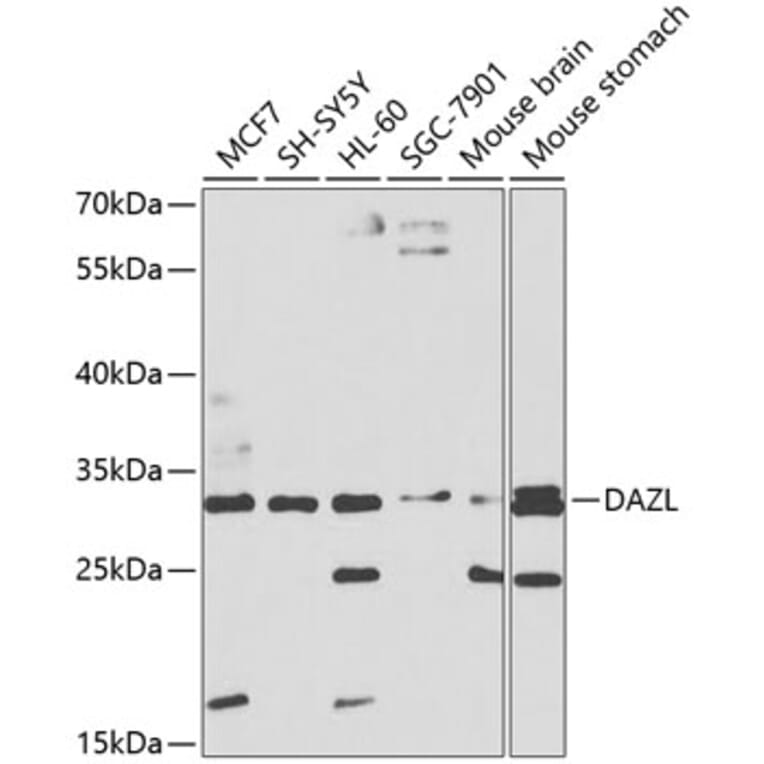 Western Blot - Anti-DAZL Antibody (A8858) - Antibodies.com