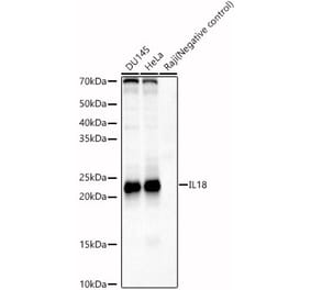 Western Blot - Anti-IL-18 Antibody (A8859) - Antibodies.com