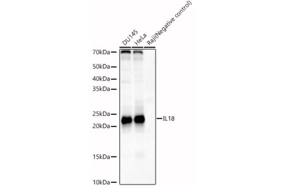 Western Blot - Anti-IL-18 Antibody (A8859) - Antibodies.com