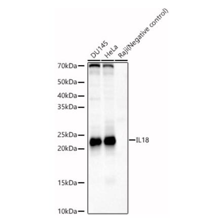Western Blot - Anti-IL-18 Antibody (A8859) - Antibodies.com