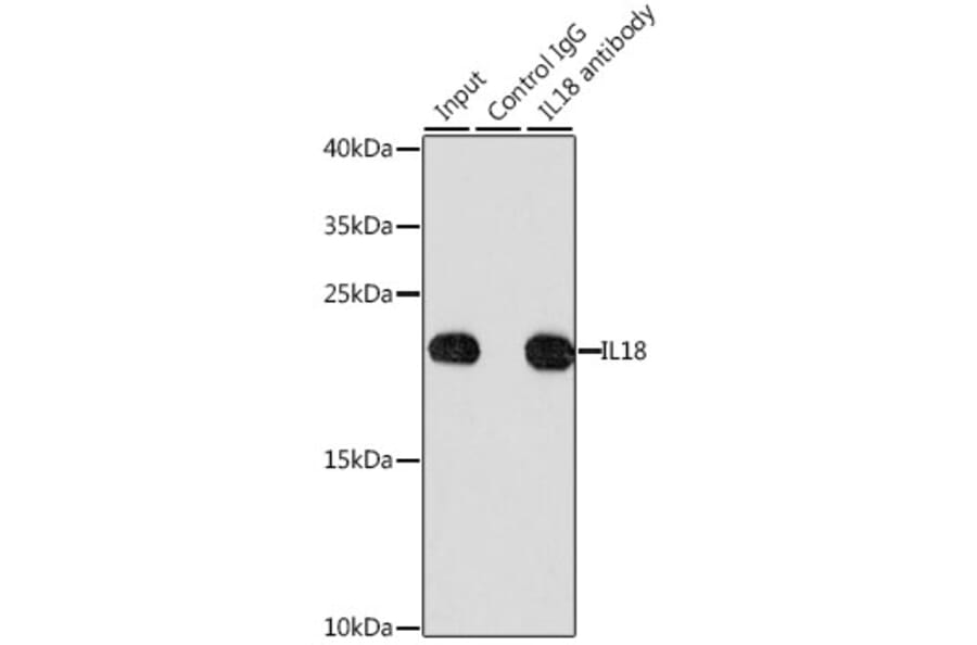 Western Blot - Anti-IL-18 Antibody (A8859) - Antibodies.com
