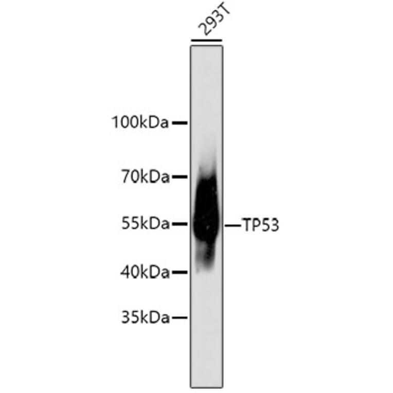 Western Blot - Anti-TP53 Antibody (A11212) - Antibodies.com