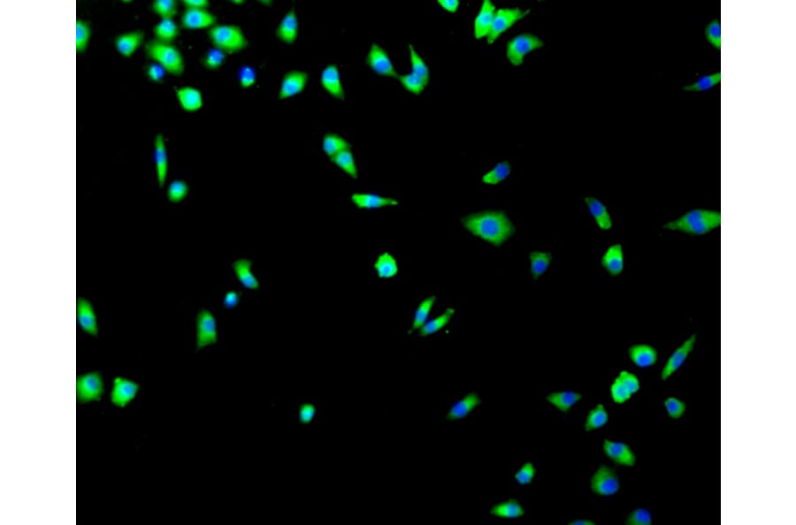 Immunofluorescence - Anti-TP53 Antibody (A11212) - Antibodies.com