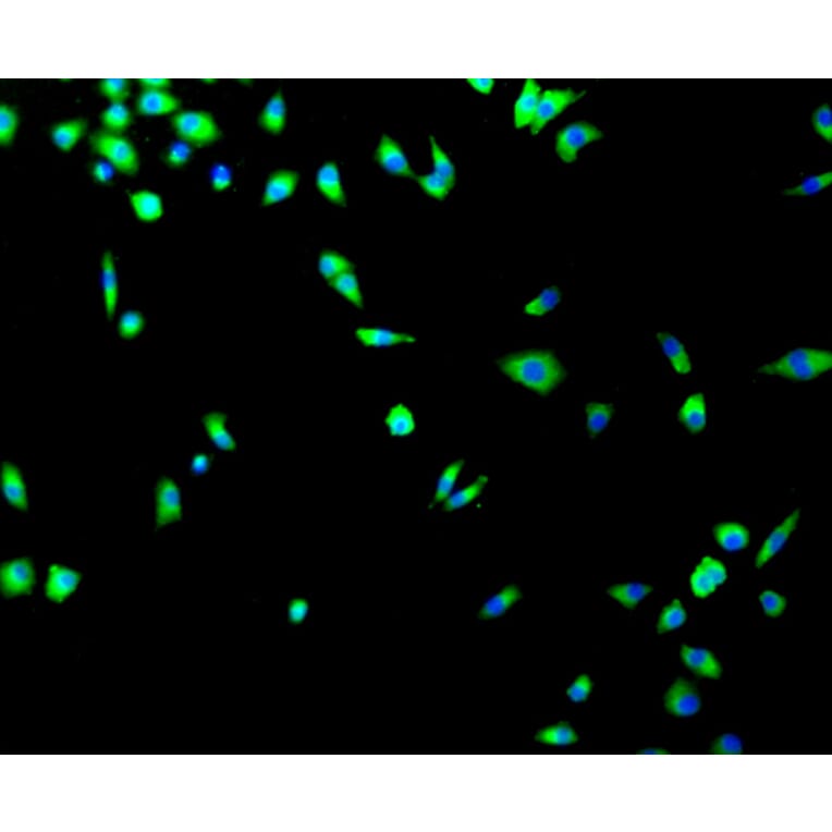 Immunofluorescence - Anti-TP53 Antibody (A11212) - Antibodies.com