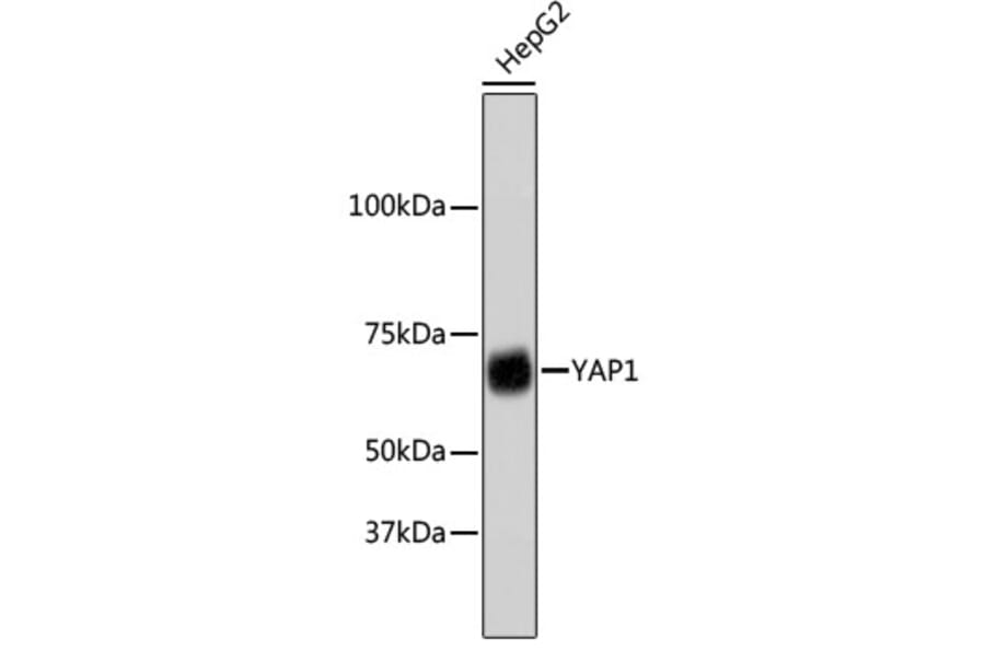 Western Blot - Anti-YAP1 Antibody (A11326) - Antibodies.com
