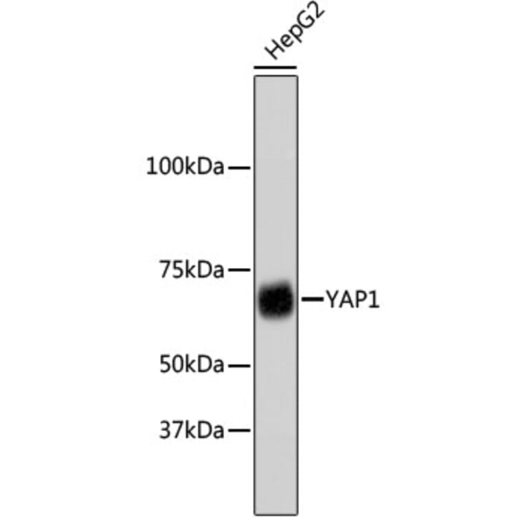 Western Blot - Anti-YAP1 Antibody (A11326) - Antibodies.com
