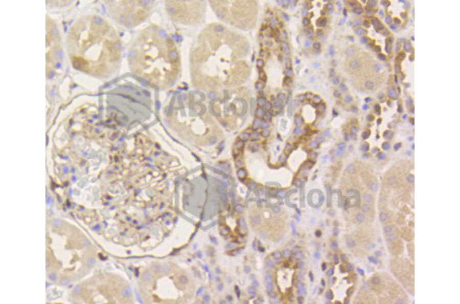 Immunohistochemistry - Anti-YAP1 Antibody (A11326) - Antibodies.com
