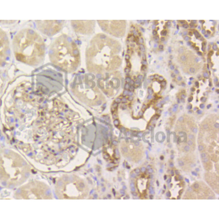 Immunohistochemistry - Anti-YAP1 Antibody (A11326) - Antibodies.com
