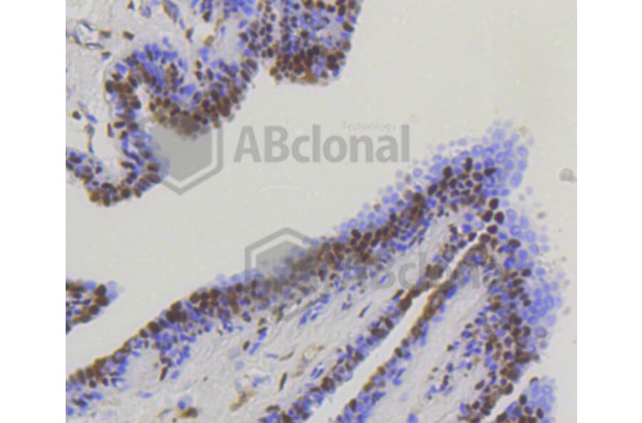Immunohistochemistry - Anti-YAP1 Antibody (A11326) - Antibodies.com