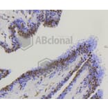 Immunohistochemistry - Anti-YAP1 Antibody (A11326) - Antibodies.com