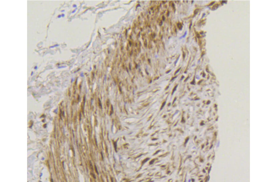 Immunohistochemistry - Anti-YAP1 Antibody (A11326) - Antibodies.com