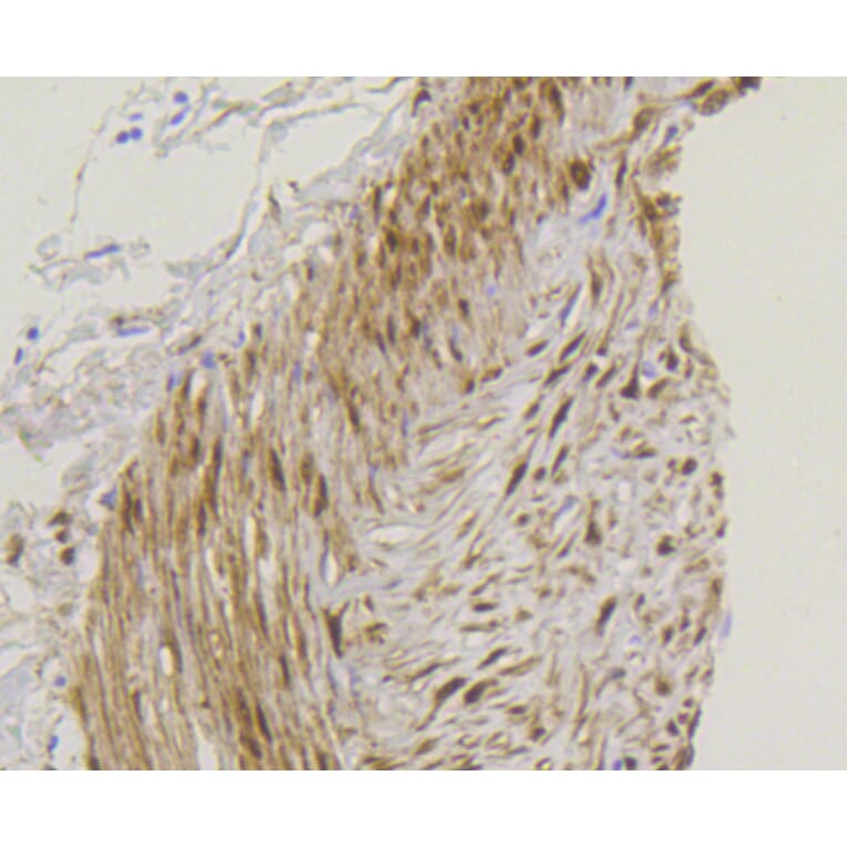 Immunohistochemistry - Anti-YAP1 Antibody (A11326) - Antibodies.com