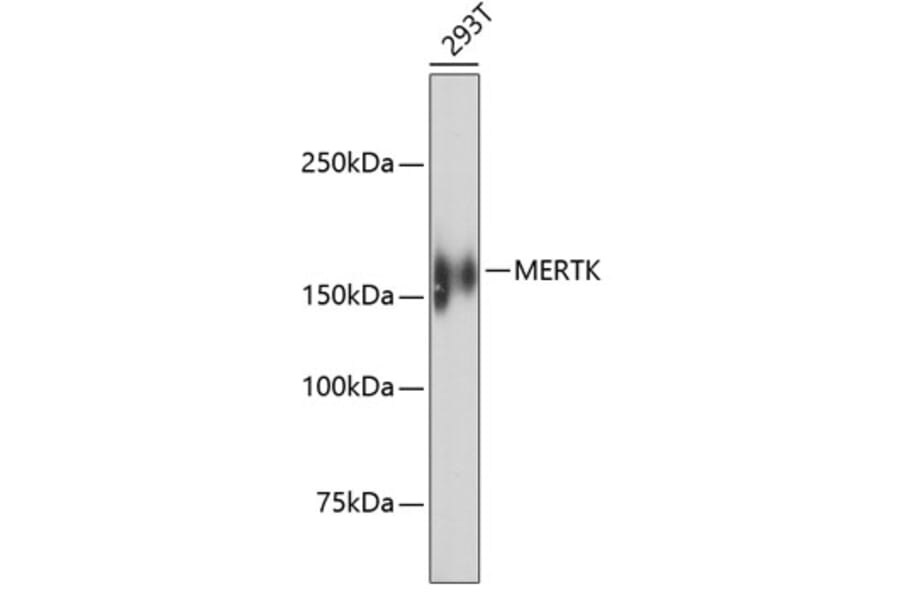 Western Blot - Anti-MERTK Antibody (A11341) - Antibodies.com