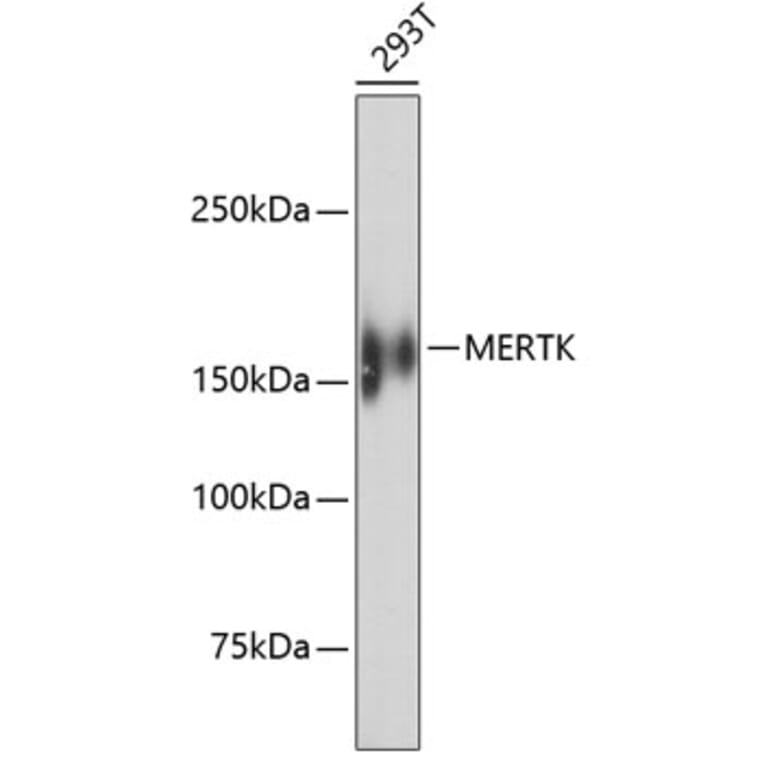 Western Blot - Anti-MERTK Antibody (A11341) - Antibodies.com