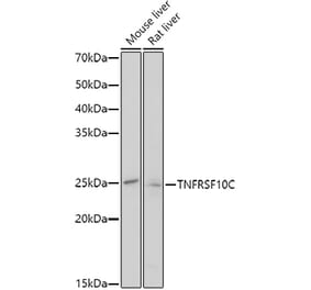 Western Blot - Anti-DcR1 Antibody (A8876) - Antibodies.com