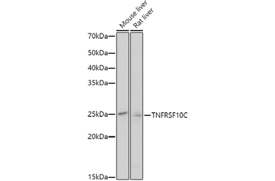 Western Blot - Anti-DcR1 Antibody (A8876) - Antibodies.com