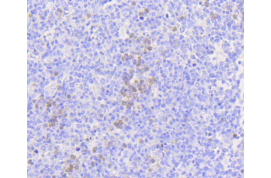 Immunohistochemistry - Anti-MLKL Antibody (A8882) - Antibodies.com